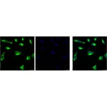 Vimentin Mouse Monoclonal Antibody (1A7) from Signalway Antibody (38097) - Antibodies.com