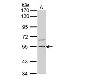 CaMKK beta antibody from Signalway Antibody (22541) - Antibodies.com