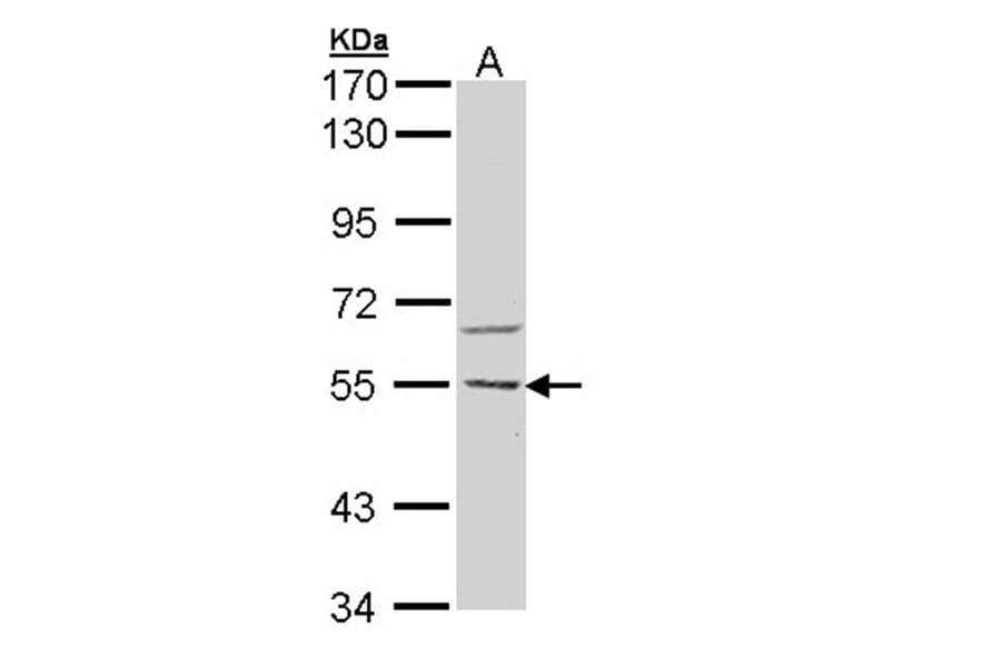 CaMKK beta antibody from Signalway Antibody (22541) - Antibodies.com