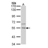 CaMKK beta antibody from Signalway Antibody (22541) - Antibodies.com