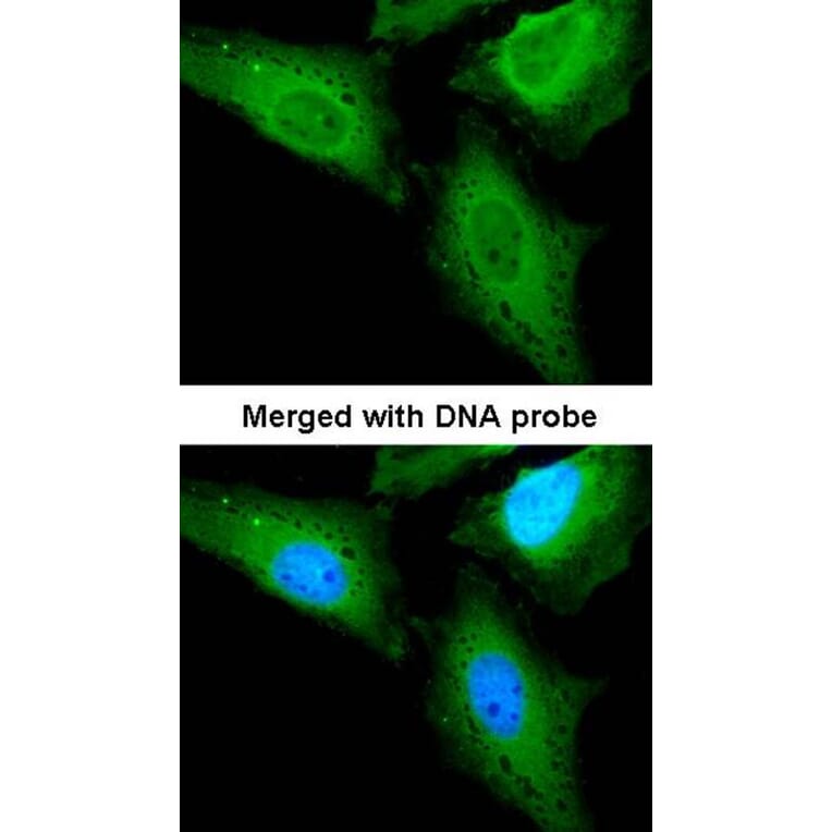 Immunofluorescence - CaMKK beta antibody from Signalway Antibody (22541) - Antibodies.com