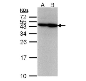 ERCC8 (CSA) antibody from Signalway Antibody (22596) - Antibodies.com