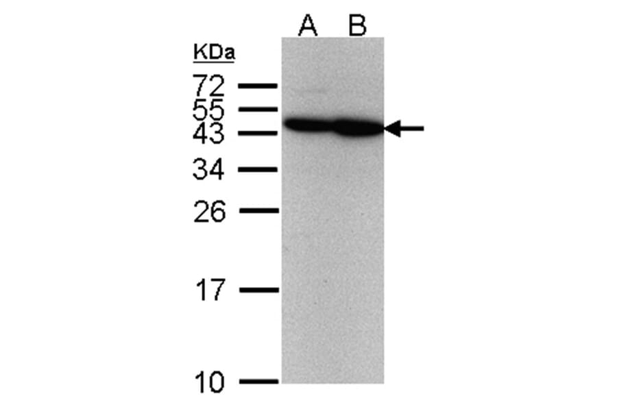 ERCC8 (CSA) antibody from Signalway Antibody (22596) - Antibodies.com