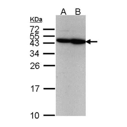 ERCC8 (CSA) antibody from Signalway Antibody (22596) - Antibodies.com