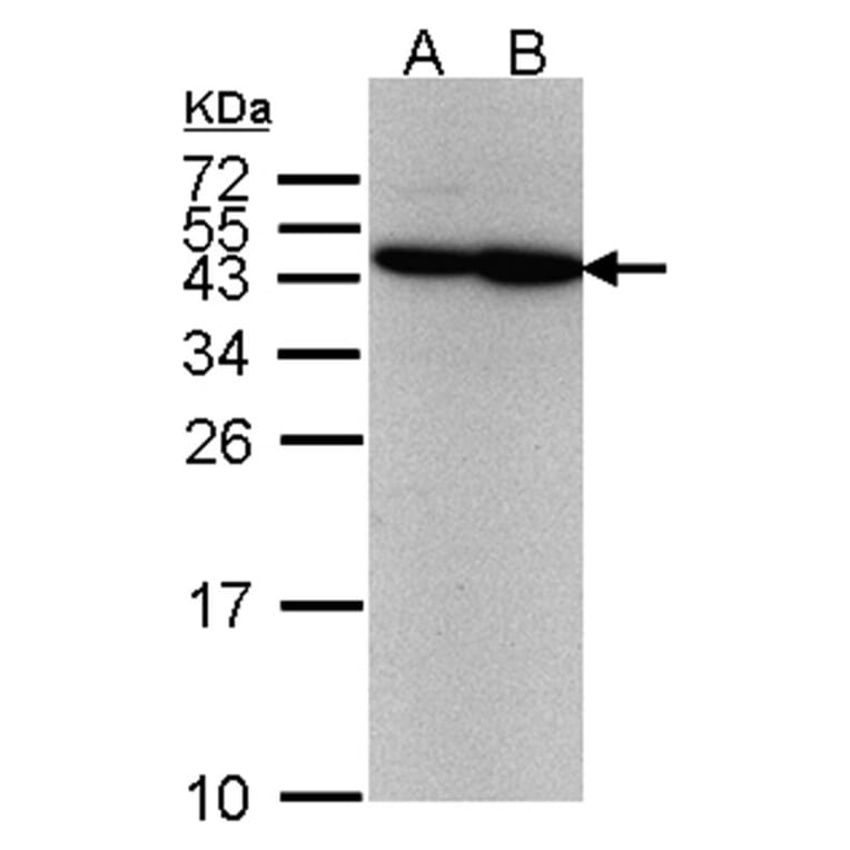 ERCC8 (CSA) antibody from Signalway Antibody (22596) - Antibodies.com