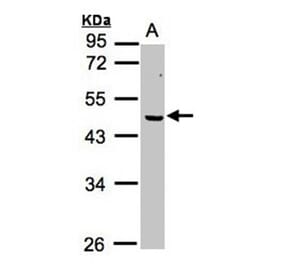 ERCC8 (CSA) antibody from Signalway Antibody (22638) - Antibodies.com