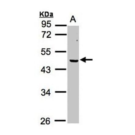 ERCC8 (CSA) antibody from Signalway Antibody (22638) - Antibodies.com