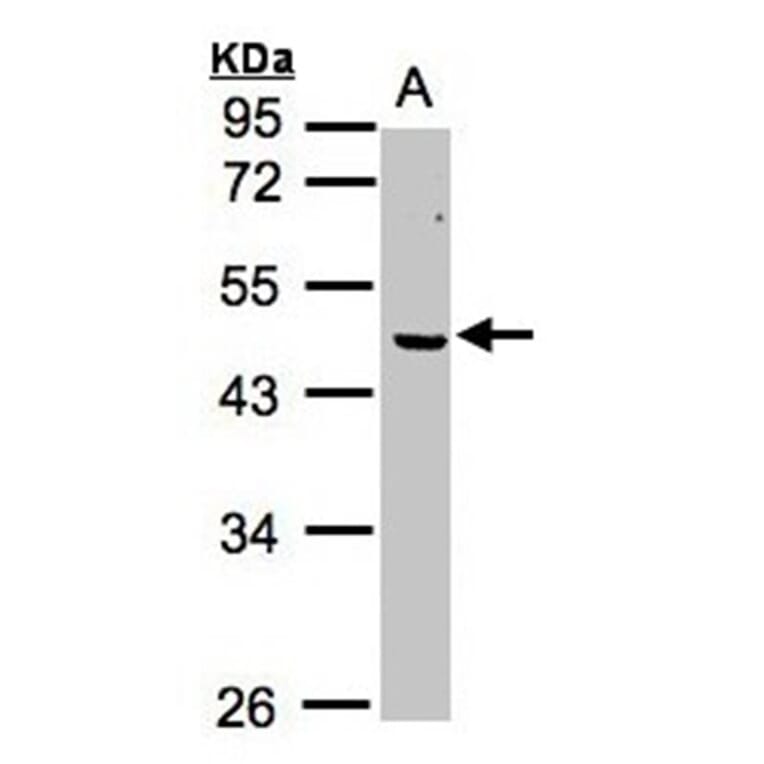ERCC8 (CSA) antibody from Signalway Antibody (22638) - Antibodies.com