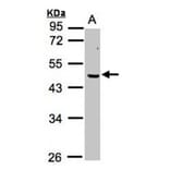 ERCC8 (CSA) antibody from Signalway Antibody (22638) - Antibodies.com