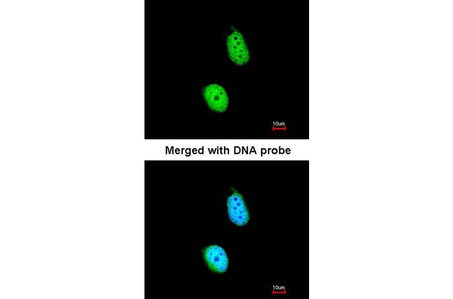 Immunofluorescence - ERCC8 (CSA) antibody from Signalway Antibody (22638) - Antibodies.com