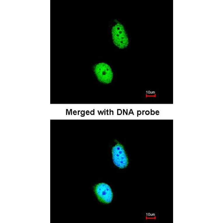 Immunofluorescence - ERCC8 (CSA) antibody from Signalway Antibody (22638) - Antibodies.com