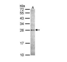 Caspase 14 antibody from Signalway Antibody (22909) - Antibodies.com