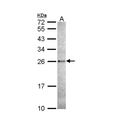 Caspase 14 antibody from Signalway Antibody (22909) - Antibodies.com