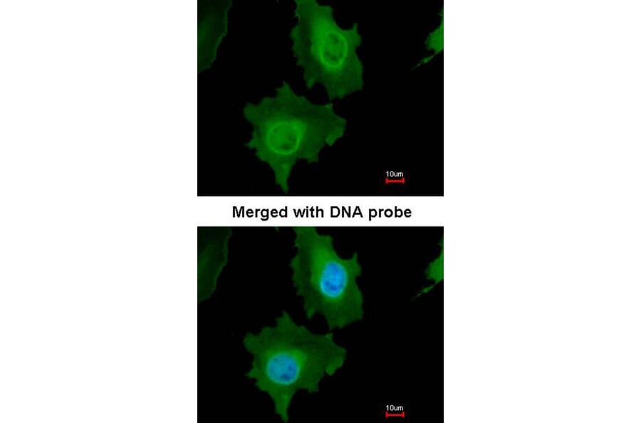 Immunofluorescence - Caspase 14 antibody from Signalway Antibody (22909) - Antibodies.com