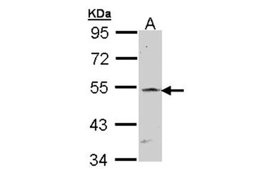 RBP-Jkappa antibody from Signalway Antibody (22930) - Antibodies.com