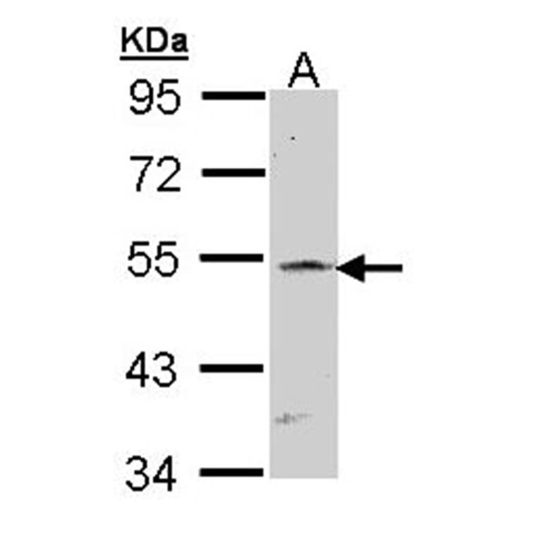 RBP-Jkappa antibody from Signalway Antibody (22930) - Antibodies.com