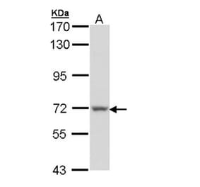 Protein S antibody from Signalway Antibody (22939) - Antibodies.com
