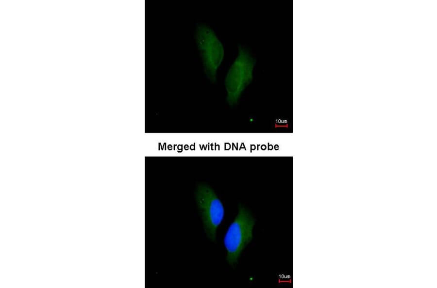 Immunofluorescence - Protein S antibody from Signalway Antibody (22939) - Antibodies.com