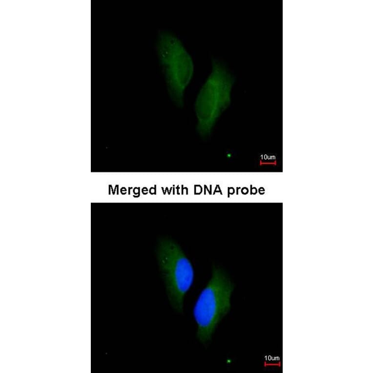 Immunofluorescence - Protein S antibody from Signalway Antibody (22939) - Antibodies.com