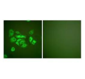 Immunofluorescence - Keratin 10 Antibody from Signalway Antibody (33422) - Antibodies.com