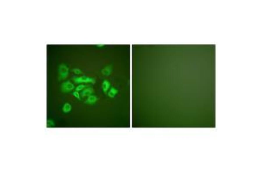 Immunofluorescence - Keratin 10 Antibody from Signalway Antibody (33422) - Antibodies.com