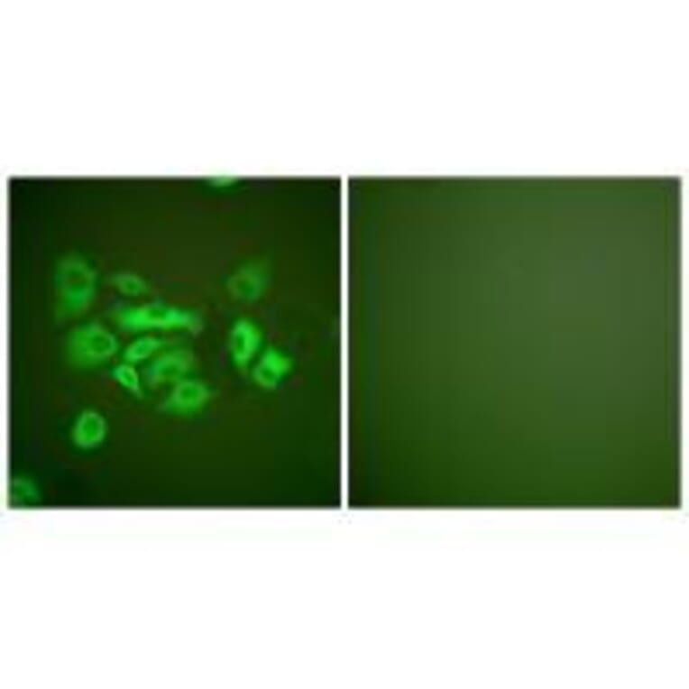 Immunofluorescence - Keratin 10 Antibody from Signalway Antibody (33422) - Antibodies.com