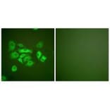 Immunofluorescence - Keratin 10 Antibody from Signalway Antibody (33422) - Antibodies.com