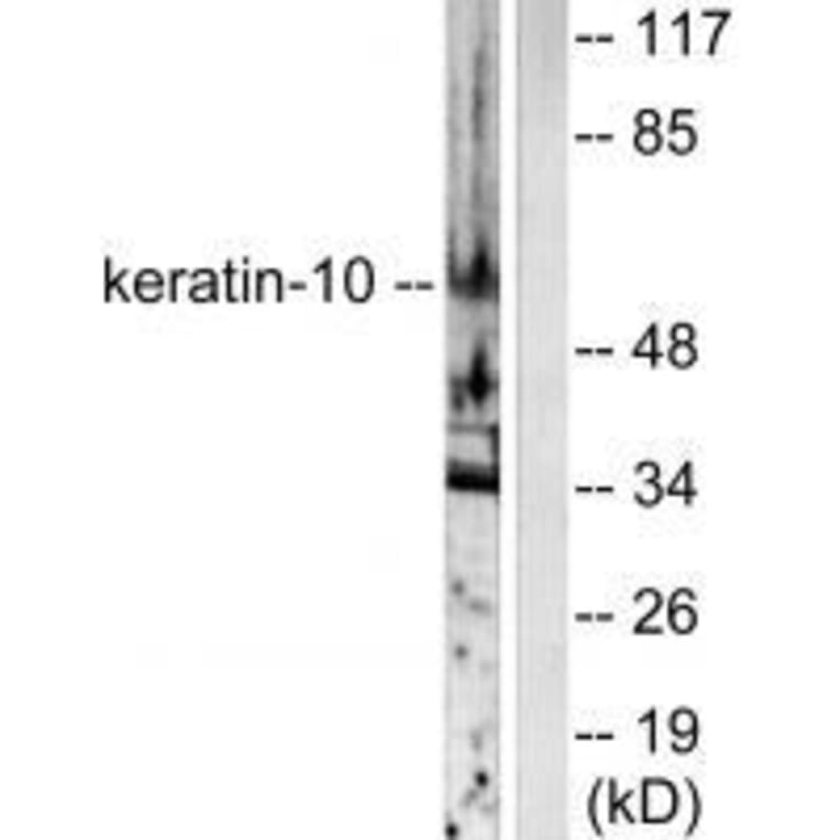 Western blot - Keratin 10 Antibody from Signalway Antibody (33422) - Antibodies.com