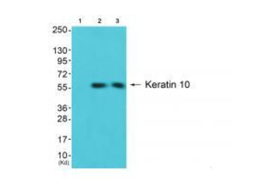 Western blot - Keratin 10 Antibody from Signalway Antibody (33422) - Antibodies.com