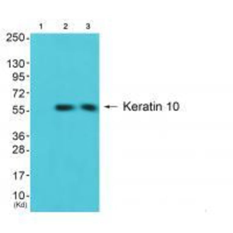 Western blot - Keratin 10 Antibody from Signalway Antibody (33422) - Antibodies.com