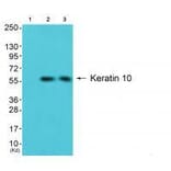 Western blot - Keratin 10 Antibody from Signalway Antibody (33422) - Antibodies.com