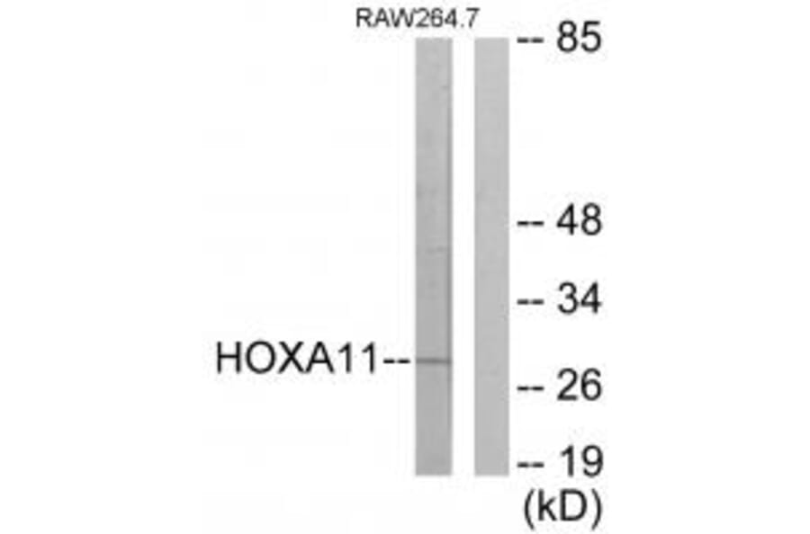 Western blot - HOXA11/D11 Antibody from Signalway Antibody (34739) - Antibodies.com
