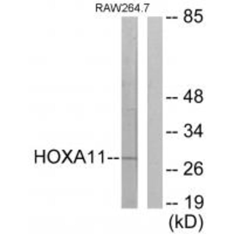 Western blot - HOXA11/D11 Antibody from Signalway Antibody (34739) - Antibodies.com