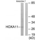 Western blot - HOXA11/D11 Antibody from Signalway Antibody (34739) - Antibodies.com