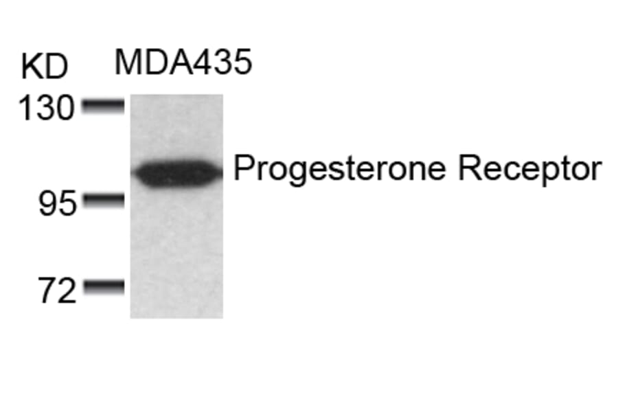 Western blot - Progesterone Receptor (Ab-190) Antibody from Signalway Antibody (21069) - Antibodies.com