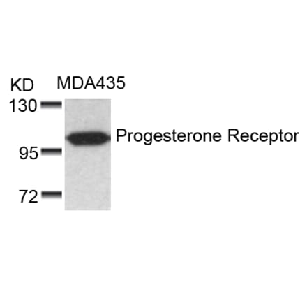 Western blot - Progesterone Receptor (Ab-190) Antibody from Signalway Antibody (21069) - Antibodies.com
