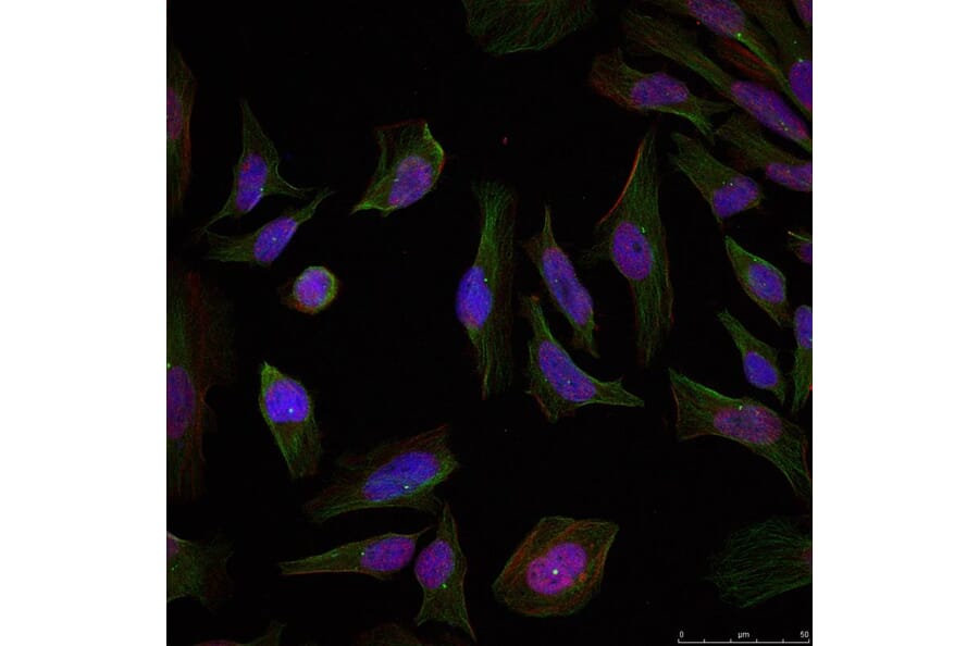 Immunofluorescence - Progesterone Receptor (Ab-190) Antibody from Signalway Antibody (21069) - Antibodies.com