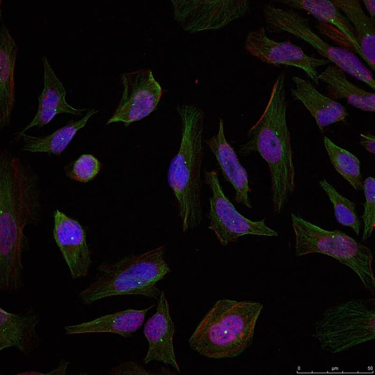 Immunofluorescence - Progesterone Receptor (Ab-190) Antibody from Signalway Antibody (21069) - Antibodies.com