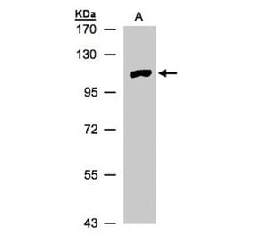 myotubularin related protein 4 antibody from Signalway Antibody (22916) - Antibodies.com