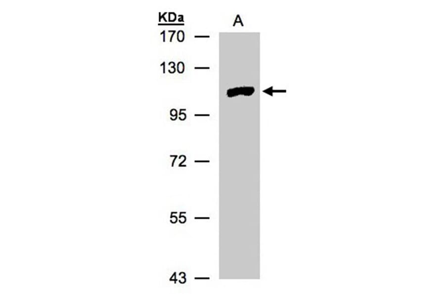 myotubularin related protein 4 antibody from Signalway Antibody (22916) - Antibodies.com