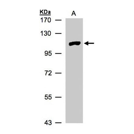 myotubularin related protein 4 antibody from Signalway Antibody (22916) - Antibodies.com