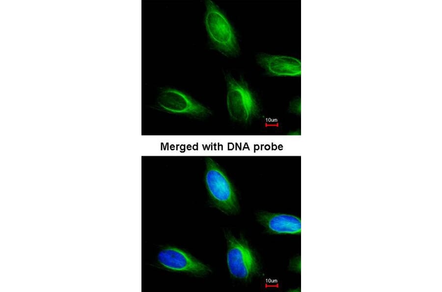 Immunofluorescence - myotubularin related protein 4 antibody from Signalway Antibody (22916) - Antibodies.com