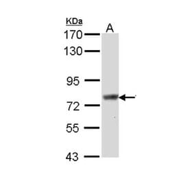 Scinderin antibody from Signalway Antibody (22158) - Antibodies.com