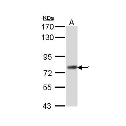 Scinderin antibody from Signalway Antibody (22158) - Antibodies.com