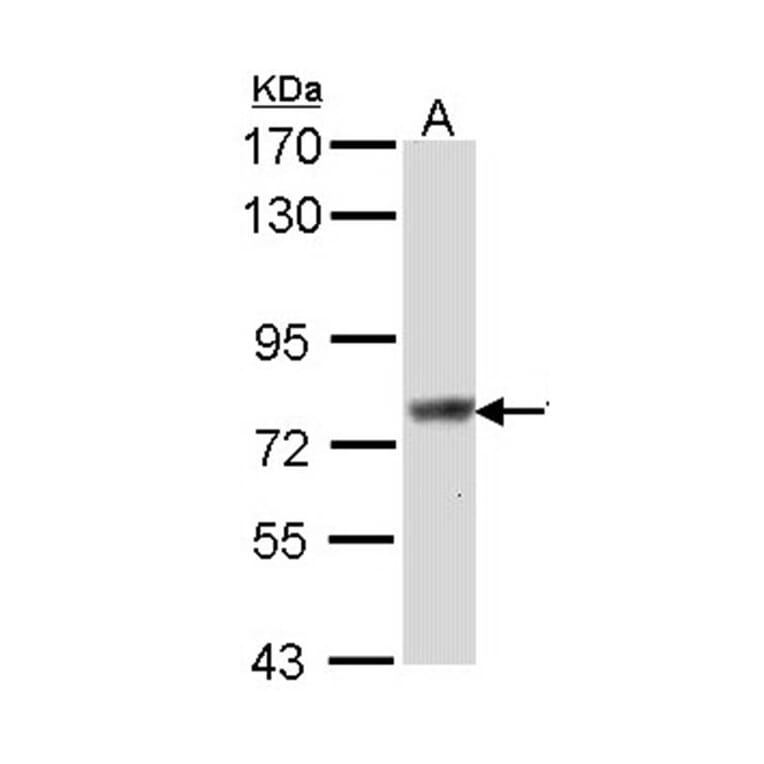 Scinderin antibody from Signalway Antibody (22158) - Antibodies.com