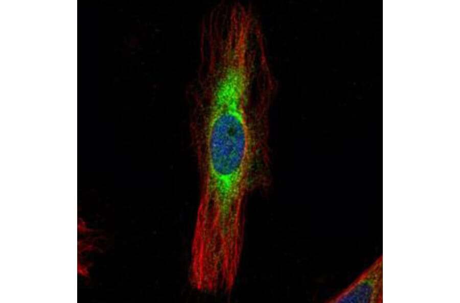 Scinderin antibody from Signalway Antibody (22158) - Antibodies.com