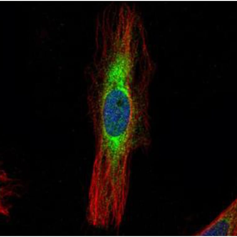 Scinderin antibody from Signalway Antibody (22158) - Antibodies.com