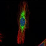 Scinderin antibody from Signalway Antibody (22158) - Antibodies.com