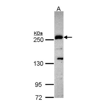 Plexin-D1 antibody from Signalway Antibody (22391) - Antibodies.com