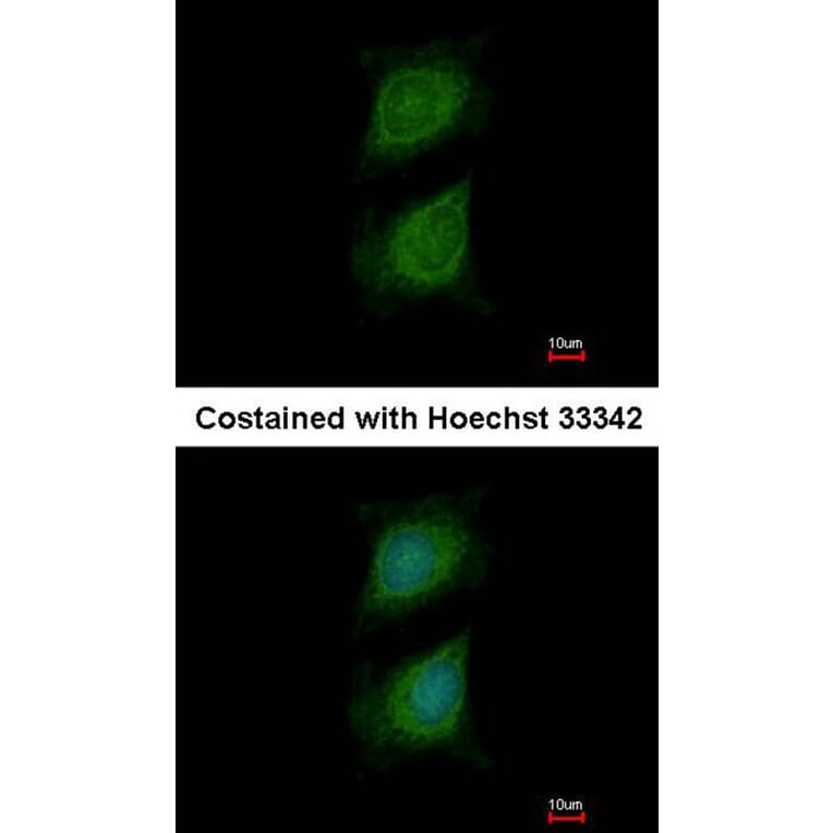 Immunofluorescence - Plexin-D1 antibody from Signalway Antibody (22391) - Antibodies.com